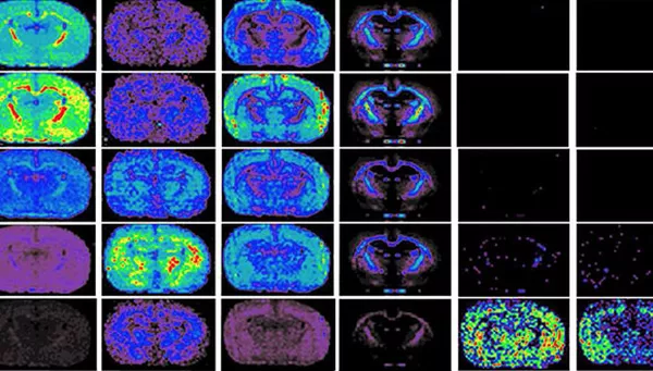 Mass spectrometry imaging and direct analysis