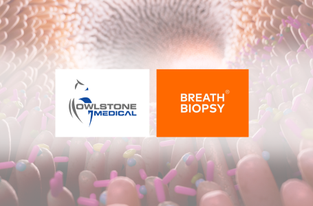 Breath analysis toolbox for gastrointestinal microbiome research (1)