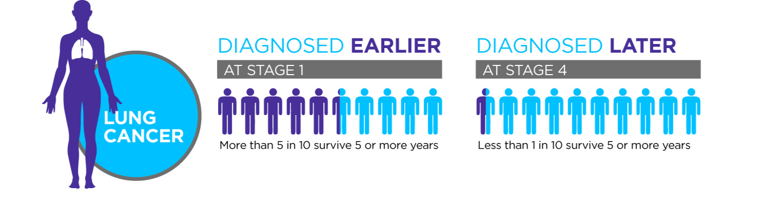 lung cancer progression