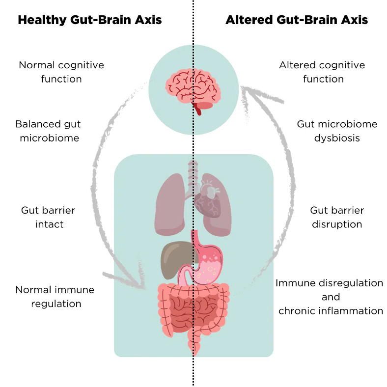 Altered gut-brain axis