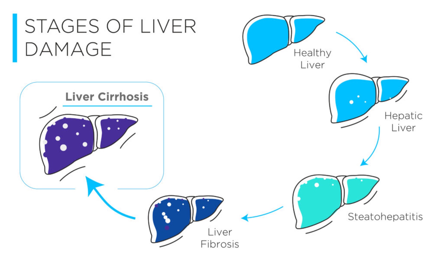 Stages of liver damage