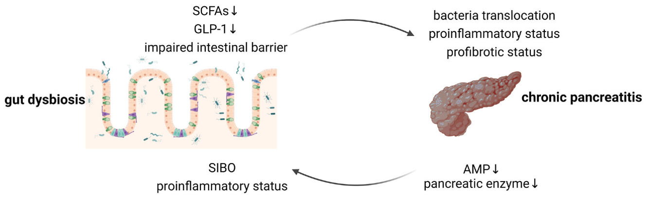 The link between the gut microbiome and pancreatitis